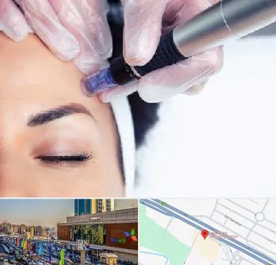 کلینیک مزوتراپی صورت در لاله پارک تبریز