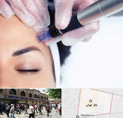 کلینیک مزوتراپی صورت در بازار تهران