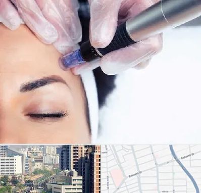 کلینیک مزوتراپی صورت در خیابان بهشتی