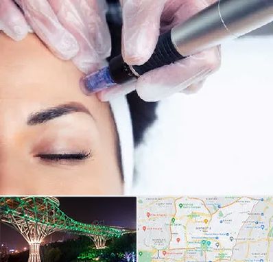 کلینیک مزوتراپی صورت در منطقه 3 تهران 