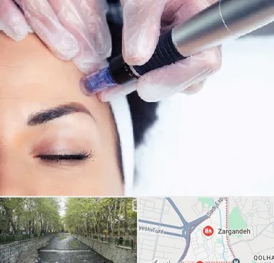 کلینیک مزوتراپی صورت در زرگنده