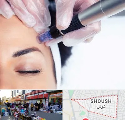 کلینیک مزوتراپی صورت در شوش