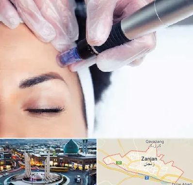 کلینیک مزوتراپی صورت در زنجان