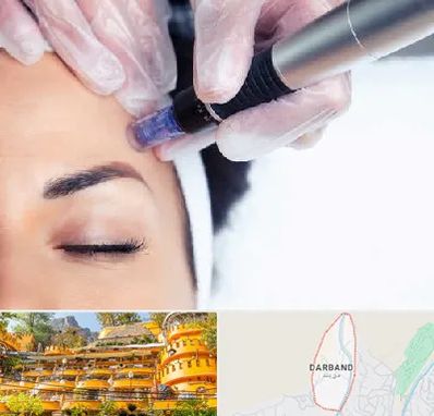 کلینیک مزوتراپی صورت در دربند