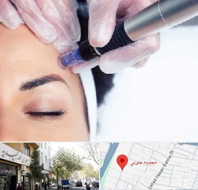 کلینیک مزوتراپی صورت در مجیدیه جنوبی