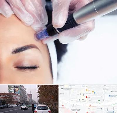 کلینیک مزوتراپی صورت در کارگر شمالی 