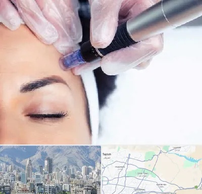 کلینیک مزوتراپی صورت در شمال شرق تهران