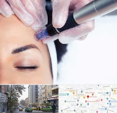 کلینیک مزوتراپی صورت در فاطمی 