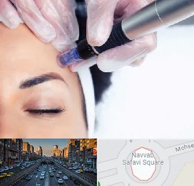 کلینیک مزوتراپی صورت در نواب