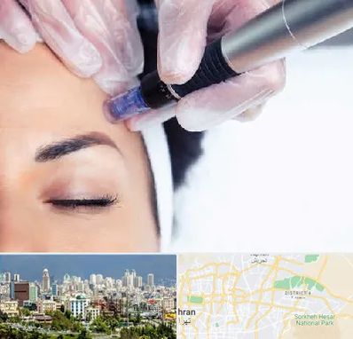 کلینیک مزوتراپی صورت در شرق تهران 