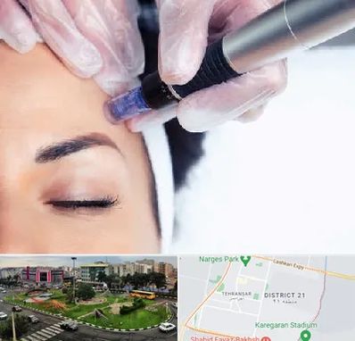 کلینیک مزوتراپی صورت در تهرانسر 