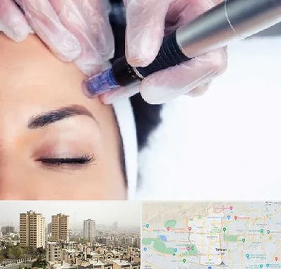 کلینیک مزوتراپی صورت در منطقه 5 تهران 