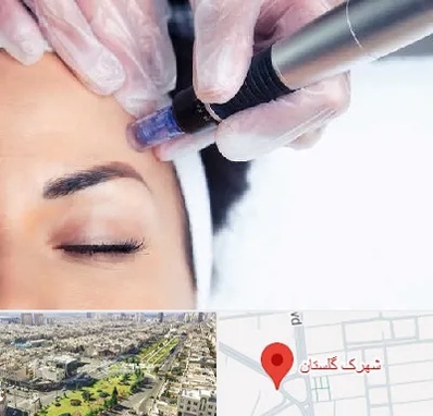 کلینیک مزوتراپی صورت در شهرک گلستان