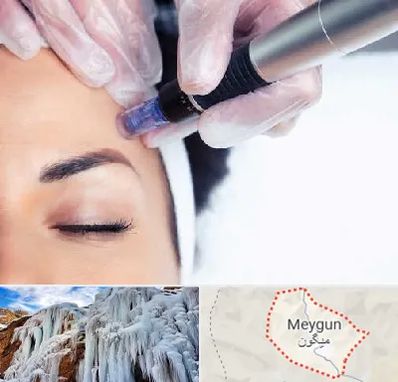 کلینیک مزوتراپی صورت در میگون