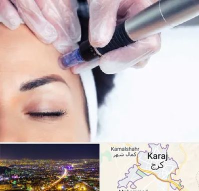 کلینیک مزوتراپی صورت در کرج