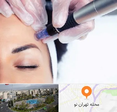 کلینیک مزوتراپی صورت در تهران نو