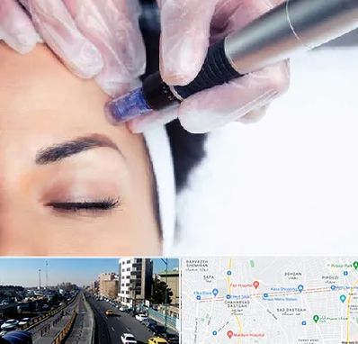 کلینیک مزوتراپی صورت در پیروزی 