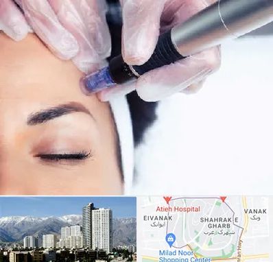 کلینیک مزوتراپی صورت در شهرک غرب 