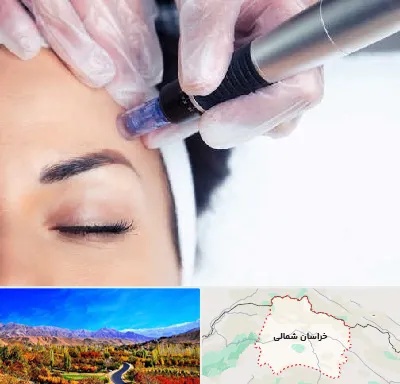کلینیک مزوتراپی صورت در خراسان شمالی