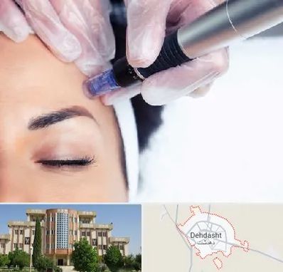 کلینیک مزوتراپی صورت در دهدشت