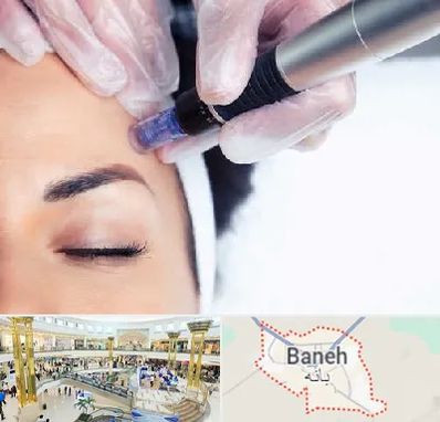 کلینیک مزوتراپی صورت در بانه