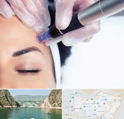 کلینیک مزوتراپی صورت در ایلام