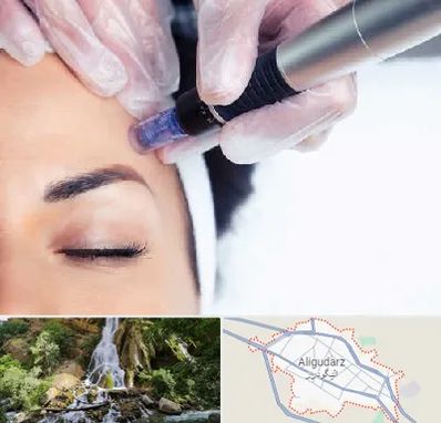 کلینیک مزوتراپی صورت در الیگودرز