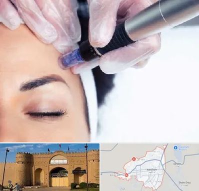 کلینیک مزوتراپی صورت در ایرانشهر