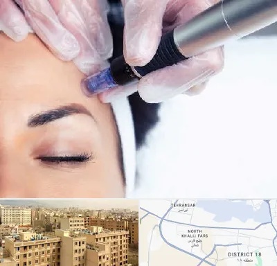 کلینیک مزوتراپی صورت در جنوب غرب تهران