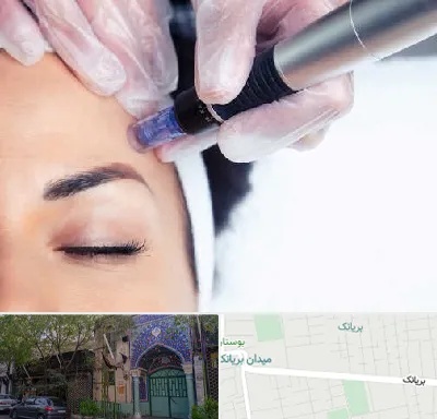 کلینیک مزوتراپی صورت در بریانک