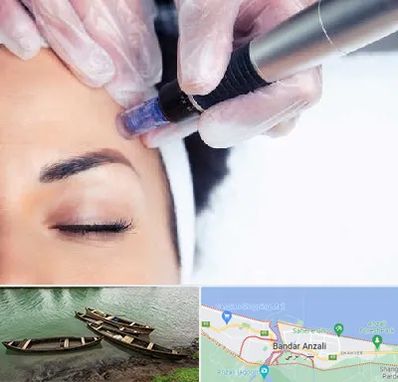 کلینیک مزوتراپی صورت در بندر انزلی