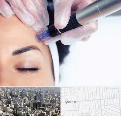 کلینیک مزوتراپی صورت در جیحون