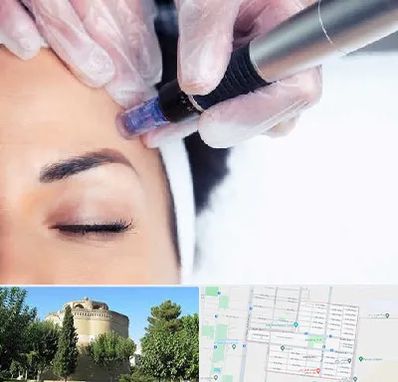 کلینیک مزوتراپی صورت در مرداویج اصفهان
