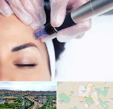 کلینیک مزوتراپی صورت در شهریار
