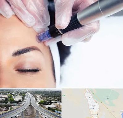 کلینیک مزوتراپی صورت در اندیمشک