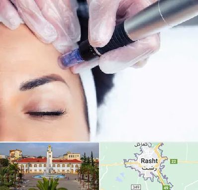 کلینیک مزوتراپی صورت در رشت