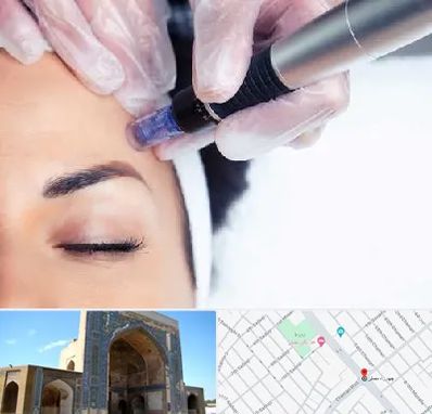 کلینیک مزوتراپی صورت در مصلی مشهد