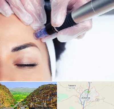 کلینیک مزوتراپی صورت در کامیاران