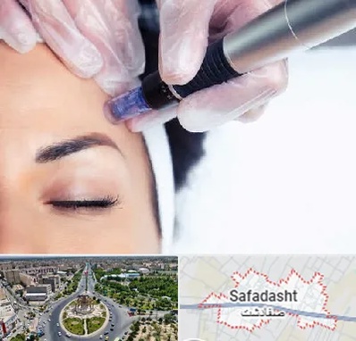 کلینیک مزوتراپی صورت در صفادشت