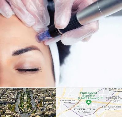 کلینیک مزوتراپی صورت در نارمک 