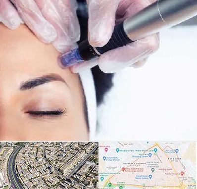 کلینیک مزوتراپی صورت در شهرک غرب مشهد