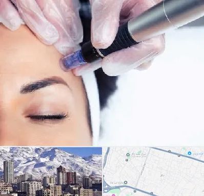 کلینیک مزوتراپی صورت در ازگل