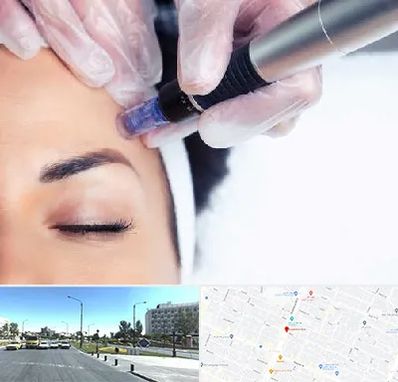 کلینیک مزوتراپی صورت در بلوار کلاهدوز مشهد