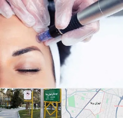 کلینیک مزوتراپی صورت در تهران ویلا