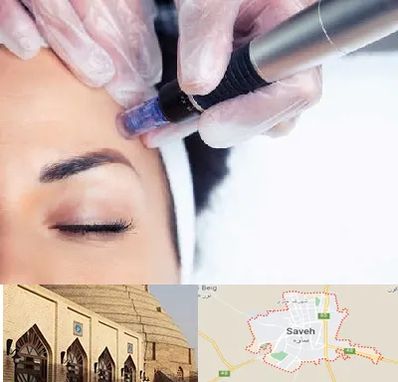 کلینیک مزوتراپی صورت در ساوه