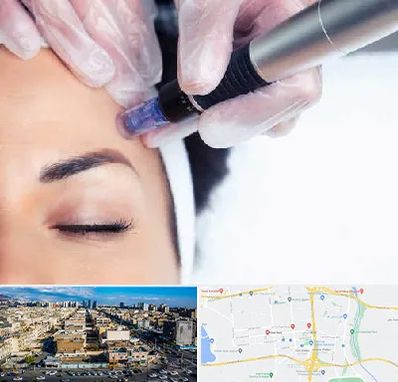 کلینیک مزوتراپی صورت در شهرک راه آهن