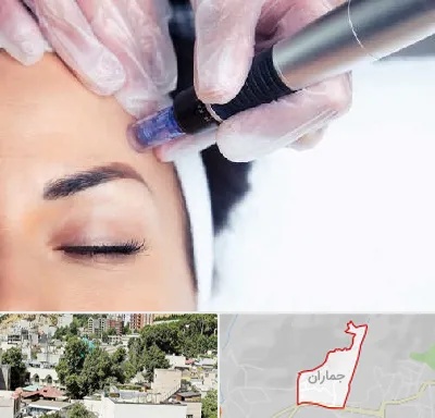 کلینیک مزوتراپی صورت در جماران