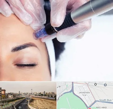 کلینیک مزوتراپی صورت در جوادیه