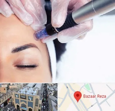 کلینیک مزوتراپی صورت در بازار رضا مشهد