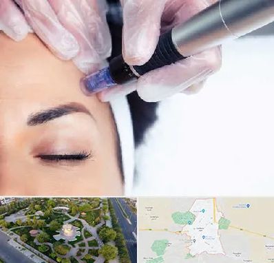 کلینیک مزوتراپی صورت در کاشمر